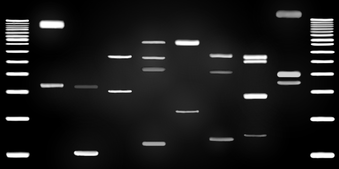 Image Type: DNA bands
